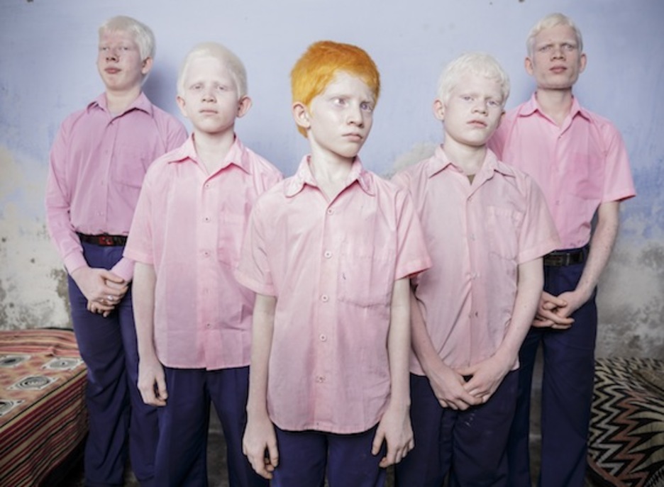 Niños albinos ciegos, vencedora en la sección People - Staged Portraits Singles. (Brent STIRTON)