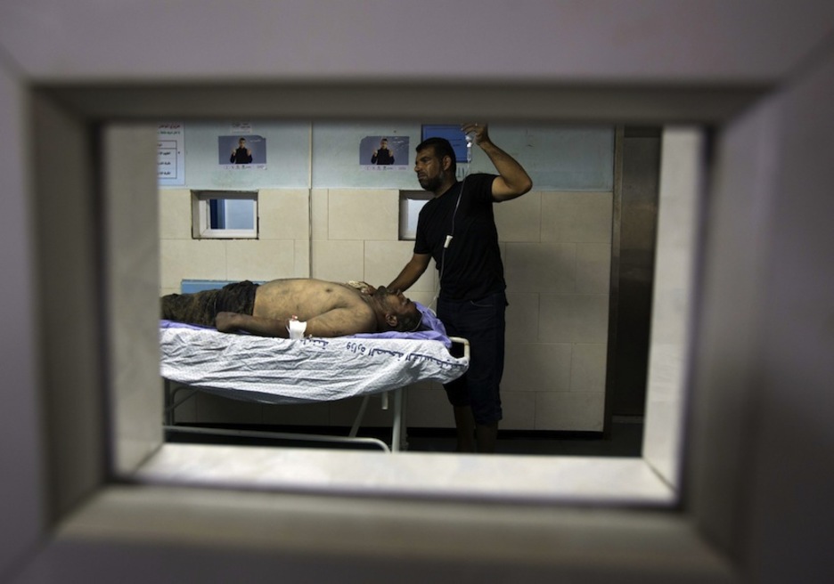 Un herido es trasladado a un hospital de Gaza. (Mohammed ABED/AFP)