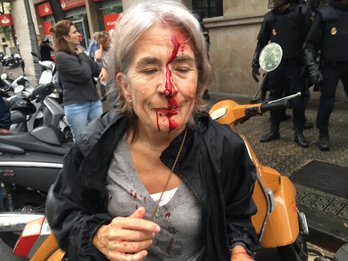 Una mujer, con la cara ensangrentada, tras la carga de la Policía española.