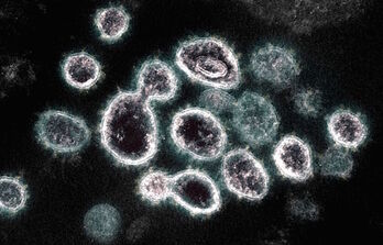 Imagen de microscopio electrónico de transmisión del SARS-CoV-2, cortesía del Instituto Nacional de Alergias y Enfermedades Infecciosas de EE UU (NIH) (foto: AFP)