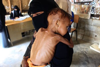 Una madre aguarda con su hija, que sufre desnutrición severa, a recibir tratamiento médico en el campo de desplazados de Abs. (Essa AHMED/AFP)