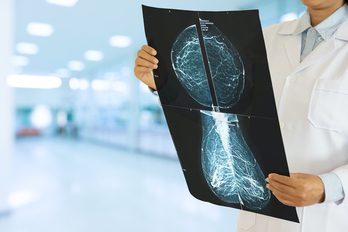 Una médico analiza una mamografía con la técnica habitual.
