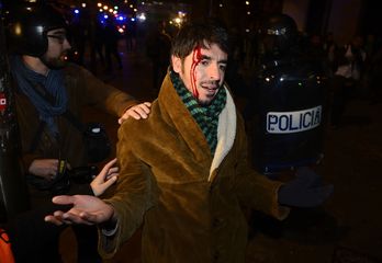 Un joven herido tras la actuación de la Policía española. (Philippe MARCOU / AFP)