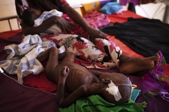 Un niño somalí con problemas de malnutrición, en brazos de su madre. (JM LOPEZ/AFP PHOTO)