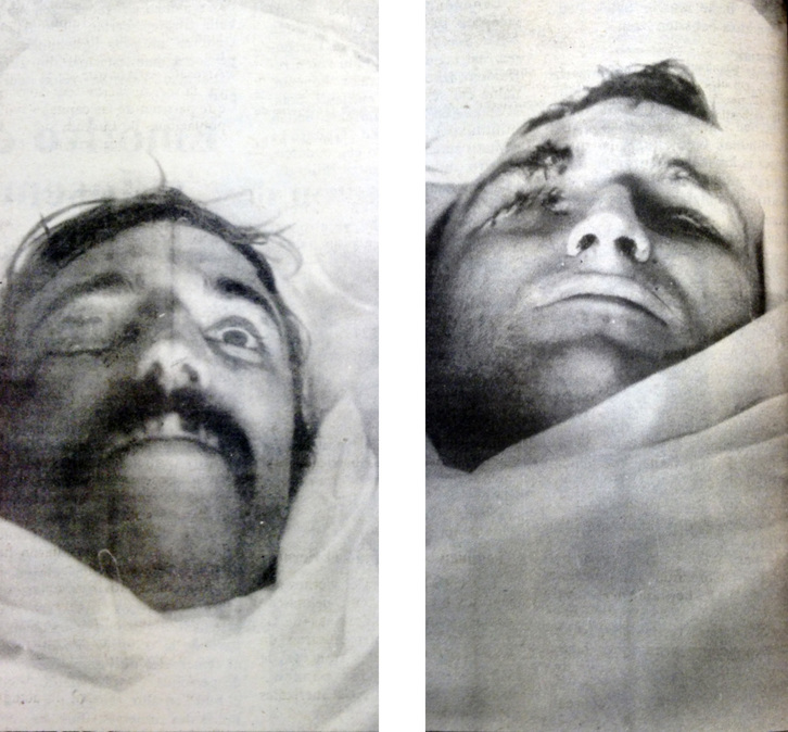 [24 de marzo] El ojo derecho de ‘Kurro’ y ‘Pelitxo’ aparecían afectados por los múltiples disparos de Pasaia. Sus cuerpos estaban acribillados. (‘EGIN’)