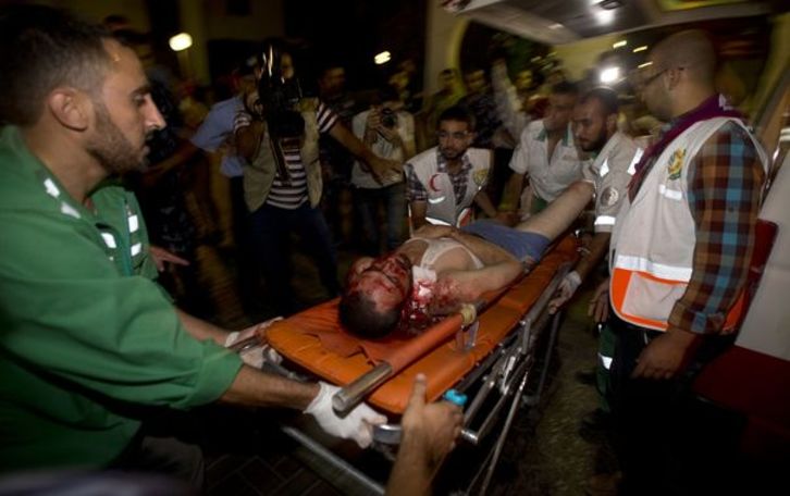 Un herido es trasladado al hospital de Shifa, en Gaza. (Mahmud HAMS/AFP)