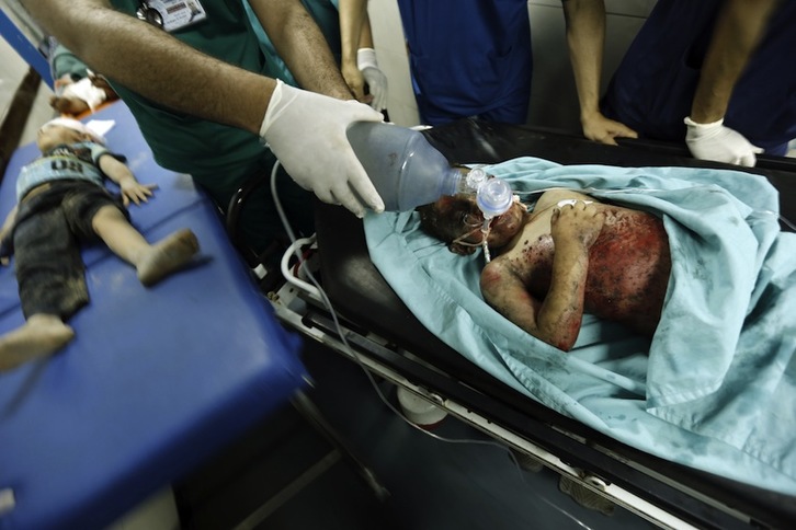 Varios niños heridos son atendidos en el hospital de Shifa. (Mohammed ABED/AFP)