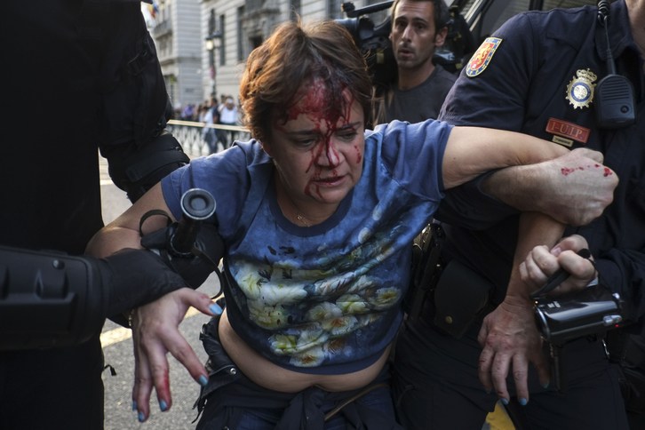 Una de las personas detenidas ensangrentada tras la carga policial. (Pedro ARMESTRE / AFP)