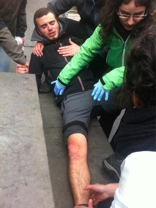 Un joven herido en una pierna. (TWITTER)