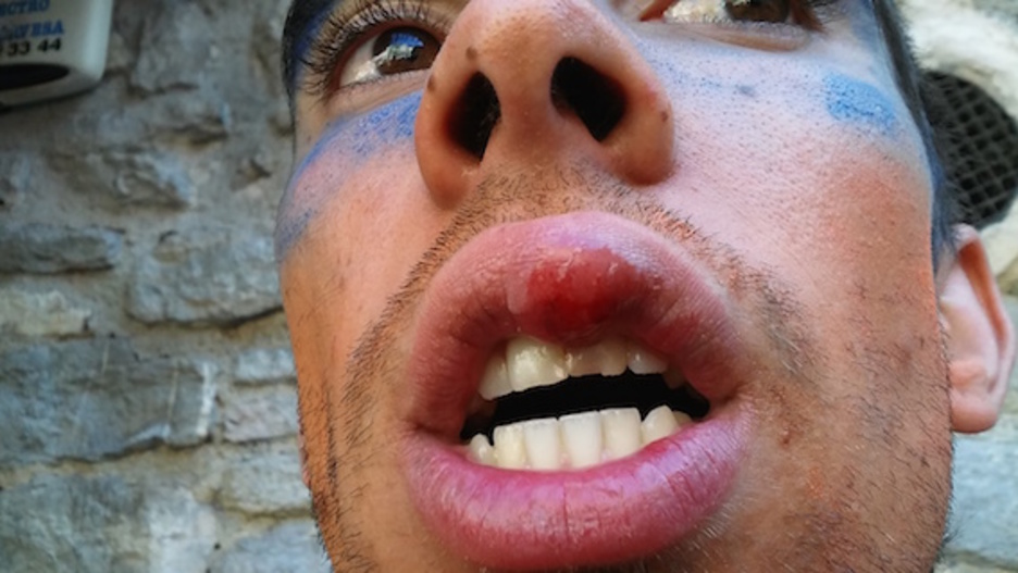 Gasteizko herri harresian kolpatutako gazteak. ©HumanWall International 