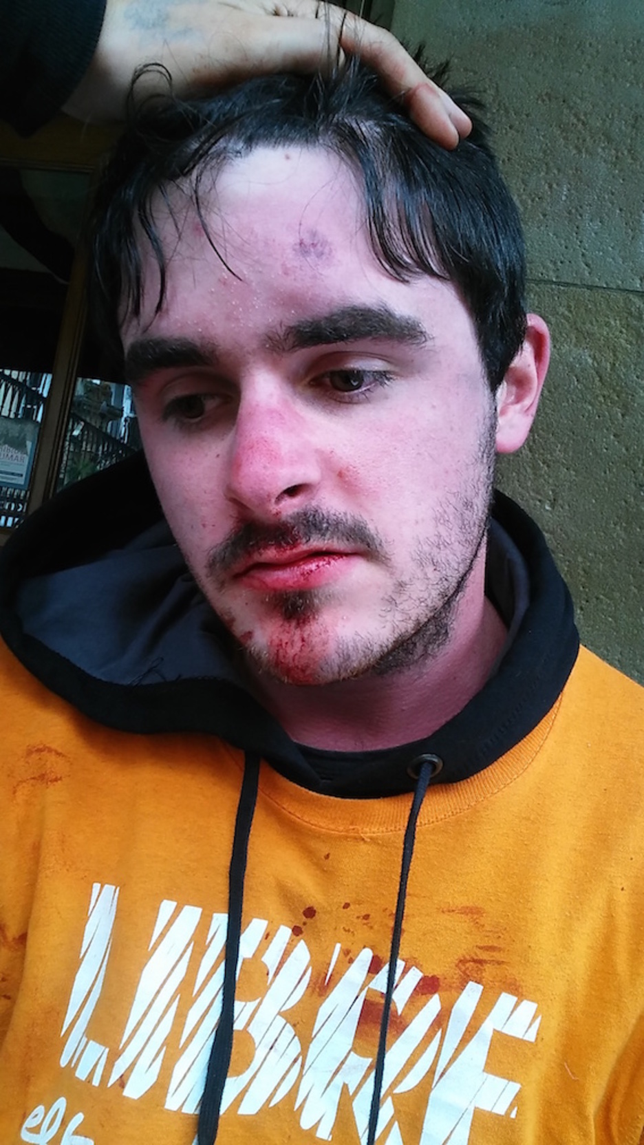 Gasteizko herri harresian kolpatutako gazteak. ©HumanWall International 