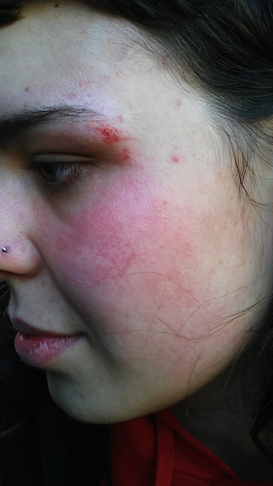 Gasteizko herri harresian kolpatutako gazteak. ©HumanWall International 