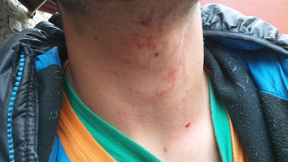 Gasteizko herri harresian kolpatutako gazteak. ©HumanWall International 