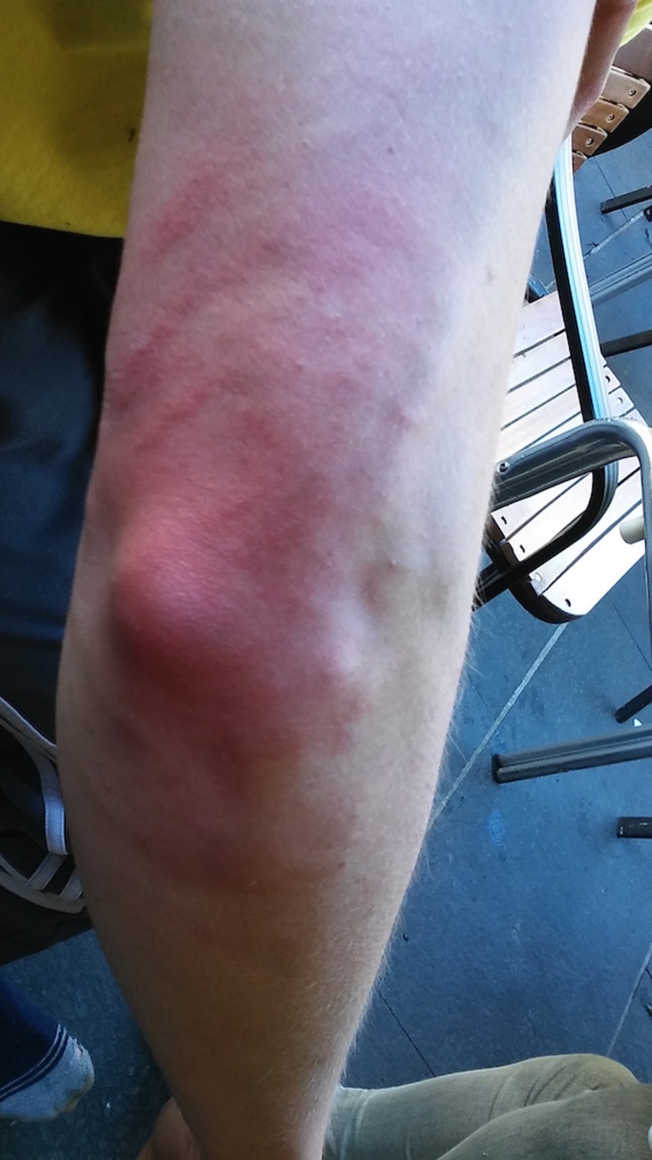 Gasteizko herri harresian kolpatutako gazteak. ©HumanWall International 