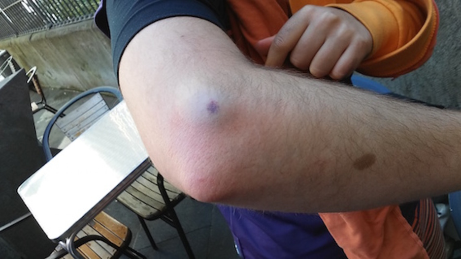 Gasteizko herri harresian kolpatutako gazteak. ©HumanWall International 