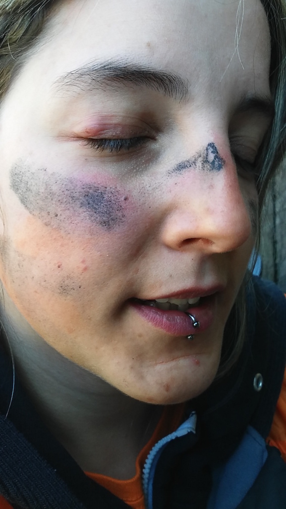 Gasteizko herri harresian kolpatutako gazteak. ©HumanWall International 