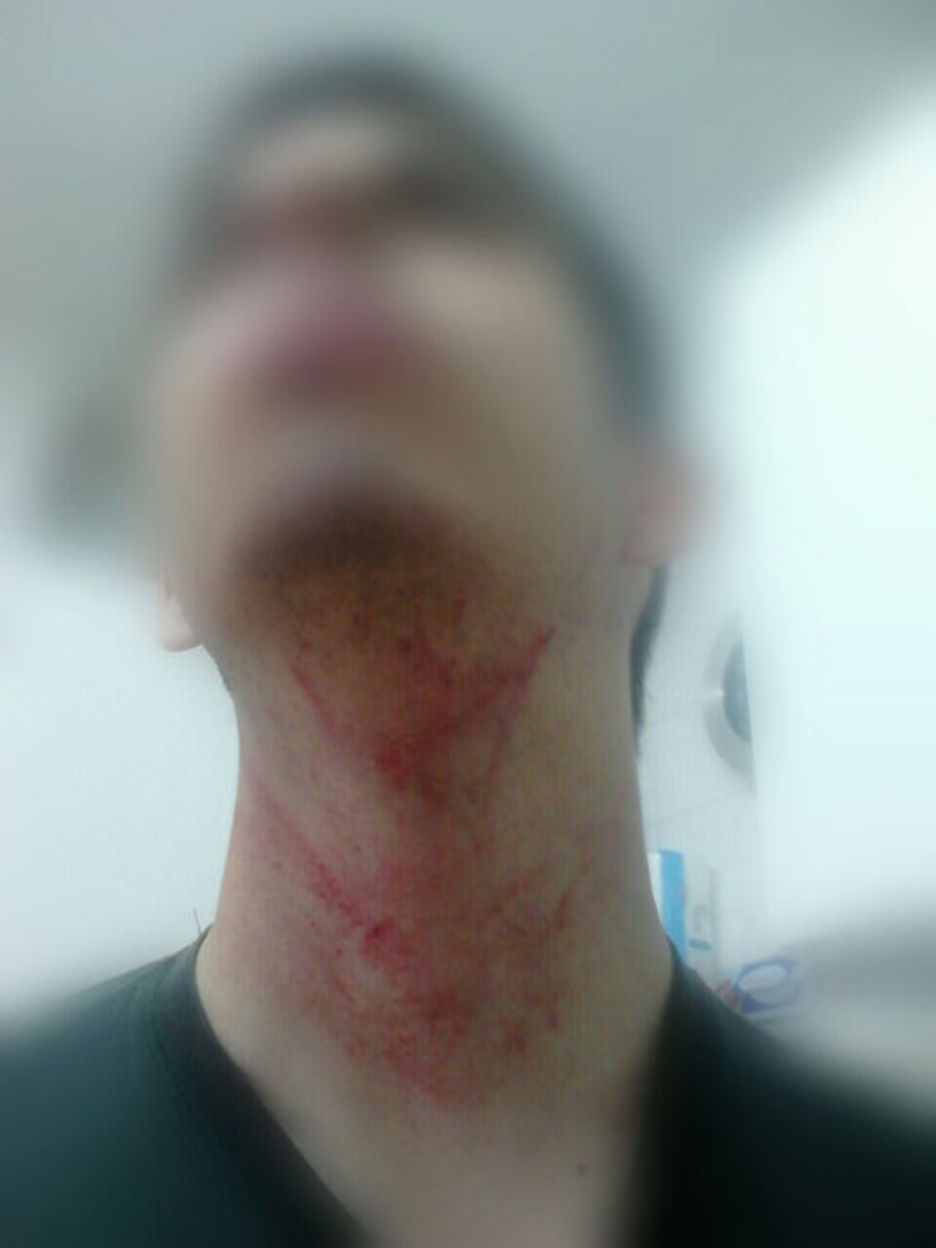 Gasteizko herri harresian kolpatutako gazteak. ©HumanWall International 