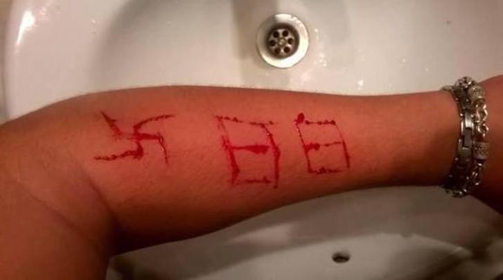 Imagen difundida sobre la agresión sufrida por el joven. 