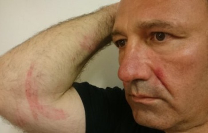 Txetx Etcheverryk Poliziaren tratu txarrak salatu ditu. (Kazeta)