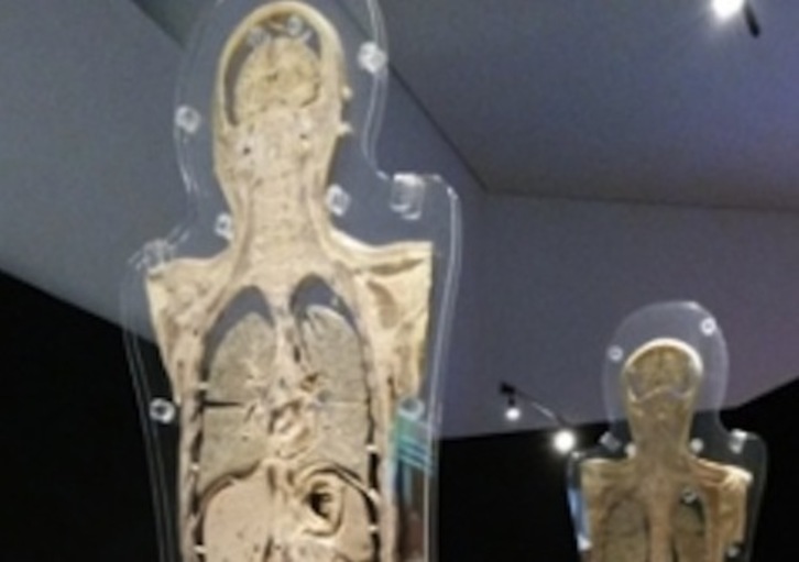 Algunas de las piezas que integran la muestra ‘Human Bodies) (BALUARTE)