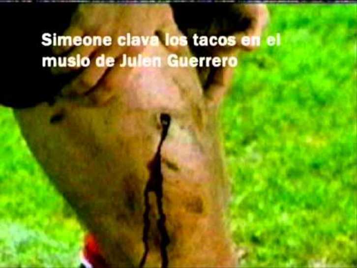 El muslo de Guerrero tras el pisotón de Simeone.