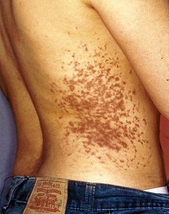 gara-2017-12-06-Noticia