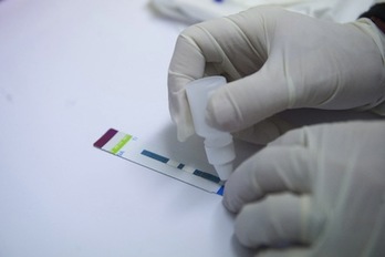 Prueba del VIH en una farmacia. (Jon URBE/FOKU)