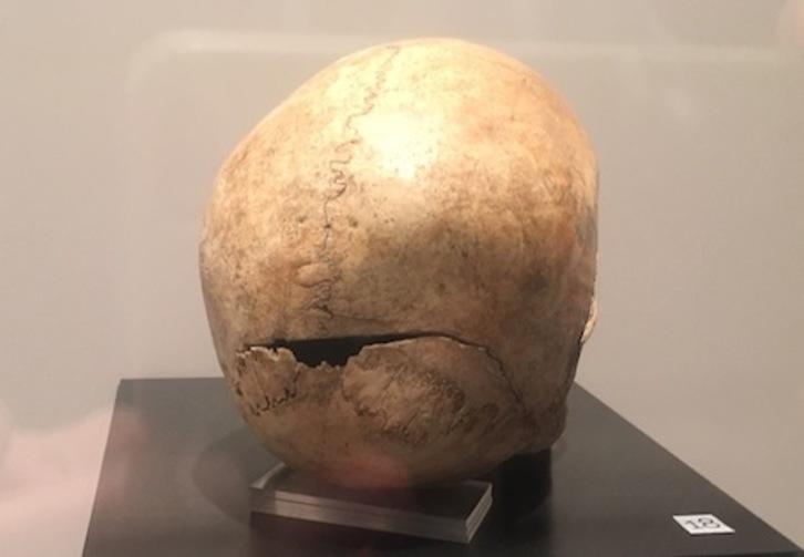 Cráneo del siglo VIII encontrado en el cementerio musulmán de la plaza del Castillo que muestra un profundo tajo.
