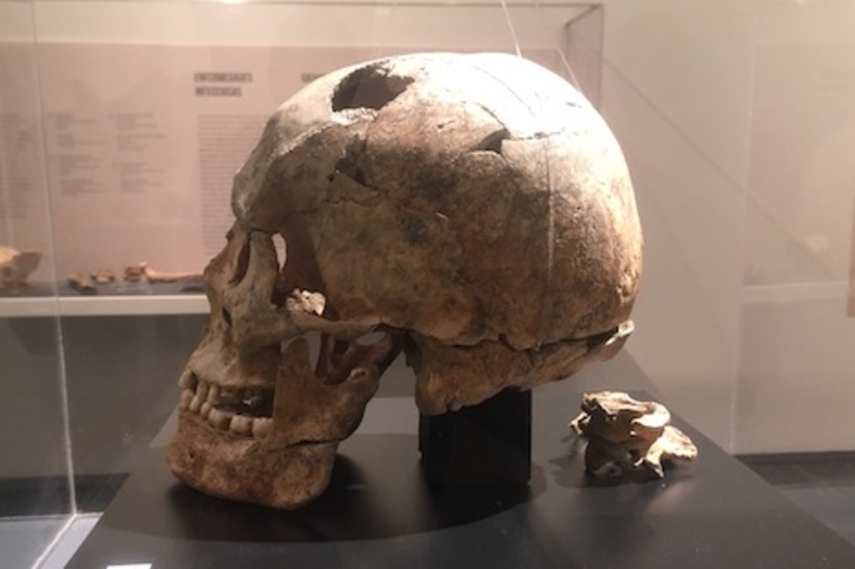 Cráneo de un hombre del siglo VIII que fue decapitado por dos golpes de espada o hacha.