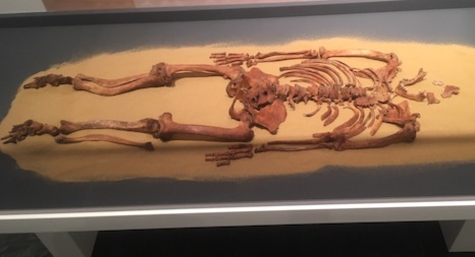 Esqueleto de una joven iruindarra del siglo XVIII que sufría enanismo.