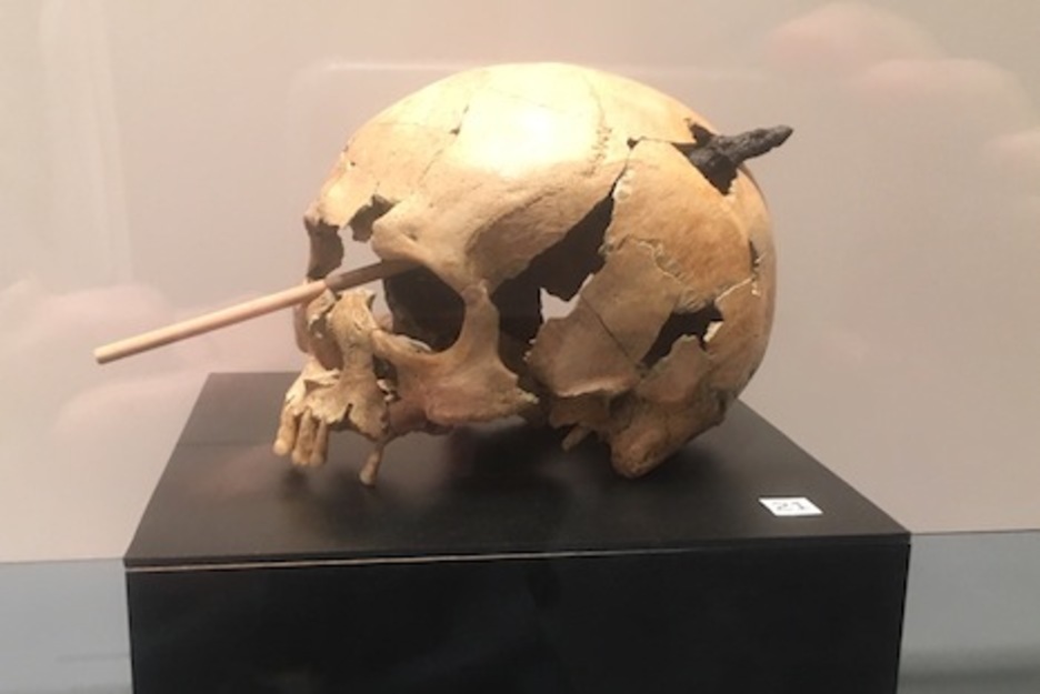 Cráneo de un hombre que falleció tras recibir el impacto de un proyectil de ballesta en Tiebas entre los siglos XIV y XVI.