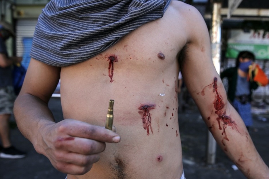 Un herido muestra un proyectil policial. (Javier TORRES | AFP)