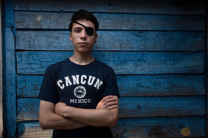 El estudiante chileno Carlos Vivanco, de 18 años, resultó herido en un ojo el 11 de noviembre. (Claudio REYES/AFP)