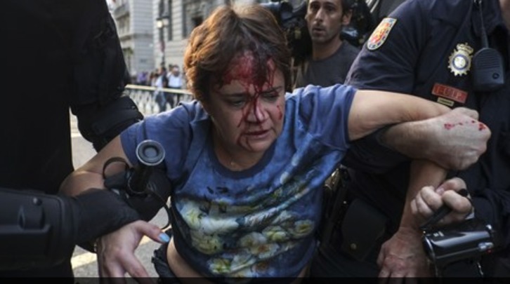 Manifestante heridas en una de las protestas ante el Congreso, esta vez en 2014. (Pedro ARMESTRE | AFP)