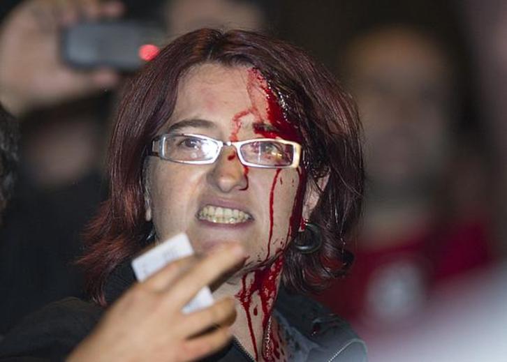 Amalur Mendizabal, tras la agresión. (Raúl BOGAJO | FOKU)