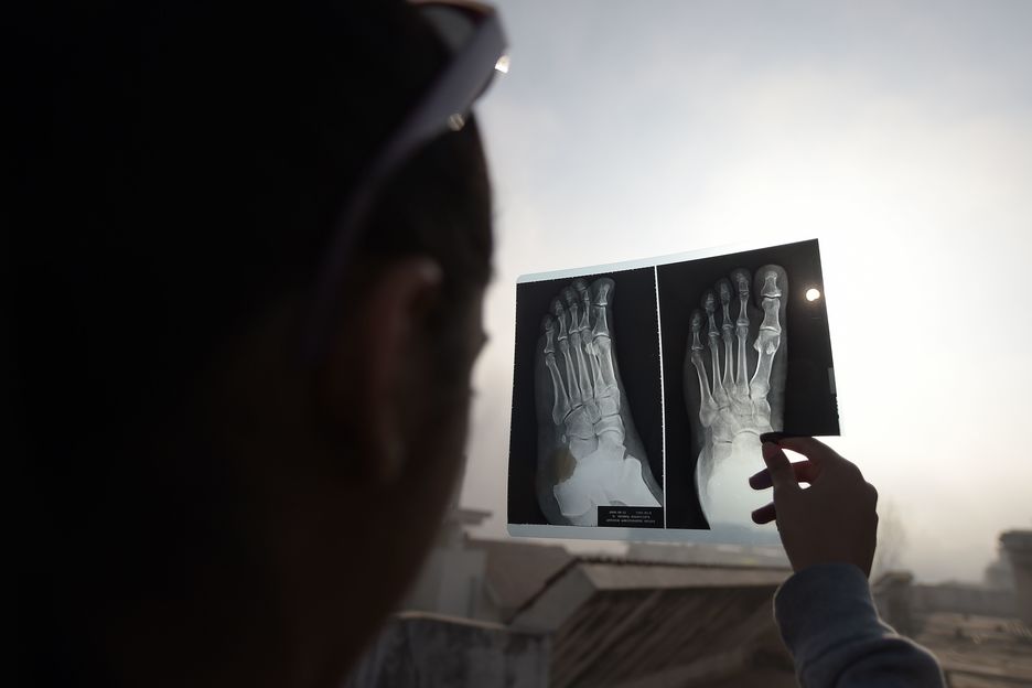 Las radiografías, útiles para mirar directamente al eclipse. (AFP) Las radiografías, útiles para mirar directamente al eclipse. (AFP)
