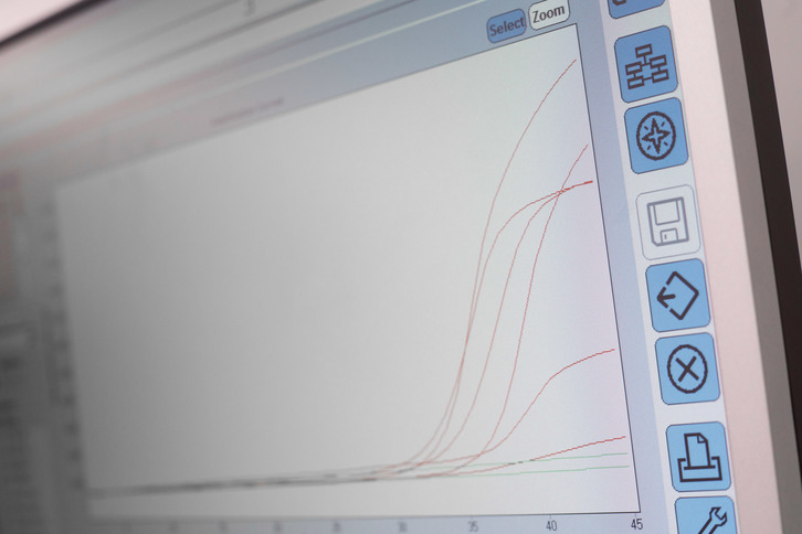 Koronabirusa frogatzen duen proba baten irudia. (Nafar Gobernua)