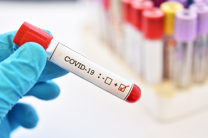 Un test para detectar el virus Covid-19. (Getty IMAGES)