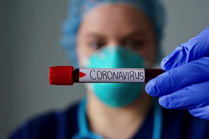 Un test para detectar el virus Covid-19. (Getty IMAGES)