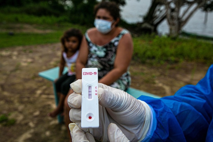 Un trabajador sanitario muestra una prueba de covid-19 en una localidad del estado brasileño de Pará. (Tarso SARRAF | AFP)