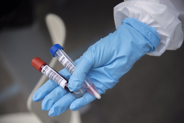 PCR eta serologia probak. (Gorka RUBIO/FOKU)