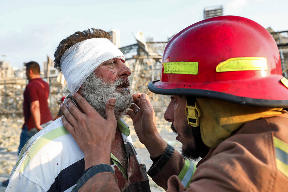 Un bombero atiende a un hombre herido tras la explosión en Beirut. (Anwar AMRO/AFP).