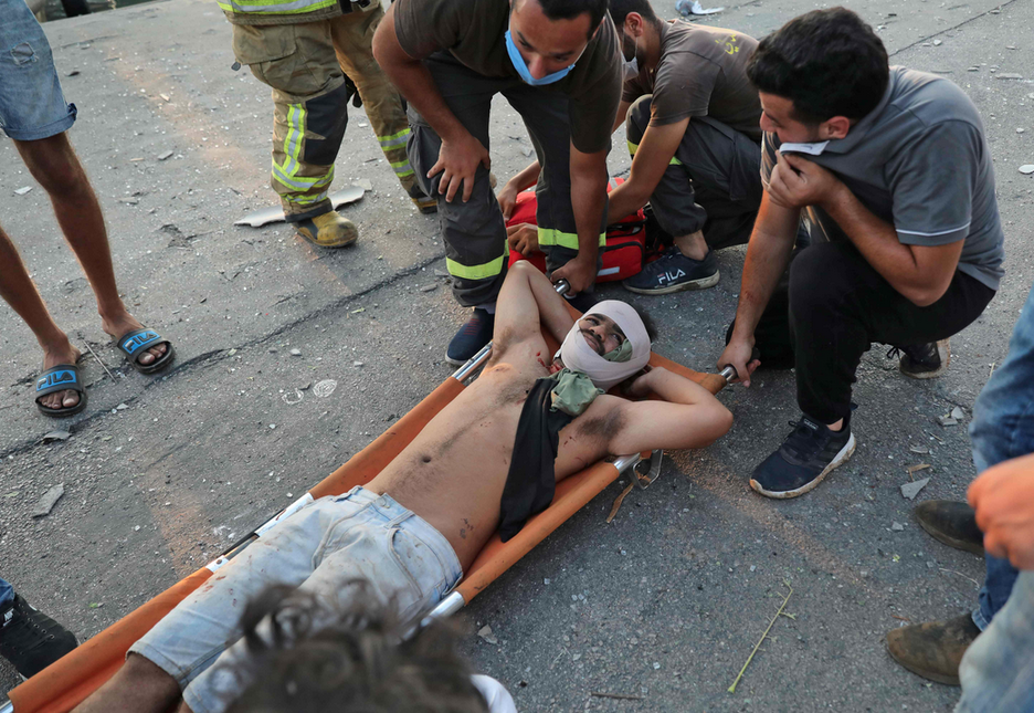 Varias personas ayudando a trasladar a un herido. (Anwar AMRO/AFP).