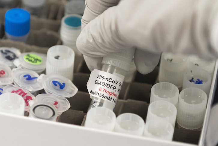 La vacuna contra el coronavirus se está desarrollando en varios laboratorios. (Andrew CABALLERO-REYNOLDS/AFP)