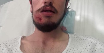 El joven herido. (Piztu Donostia)