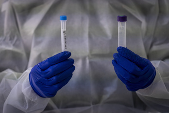 Test de antígenos. (Gorka RUBIO/FOKU)