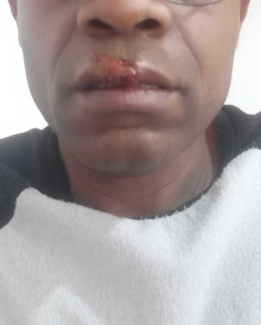 Bilboko eraso arrazistaren biktimaren irudia. (NAIZ)