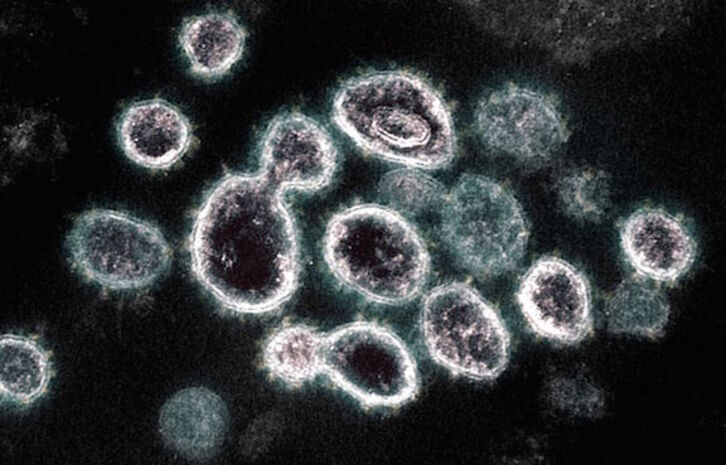 Imagen de microscopio electrónico de transmisión del SARS-CoV-2, cortesía del Instituto Nacional de Alergias y Enfermedades Infecciosas de EEUU. (AFP)