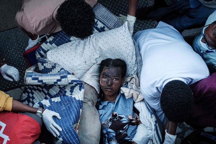 Una persona herida llega en camilla a un hospital de Mekele, la capital de la región de Tigray, en Etiopía, el 23 de junio de 2021. (Yasuyoshi CHIBA/AFP)