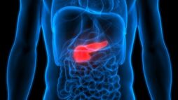 El cáncer de pancreas, al ser detectado tarde, suele producir metástasis.